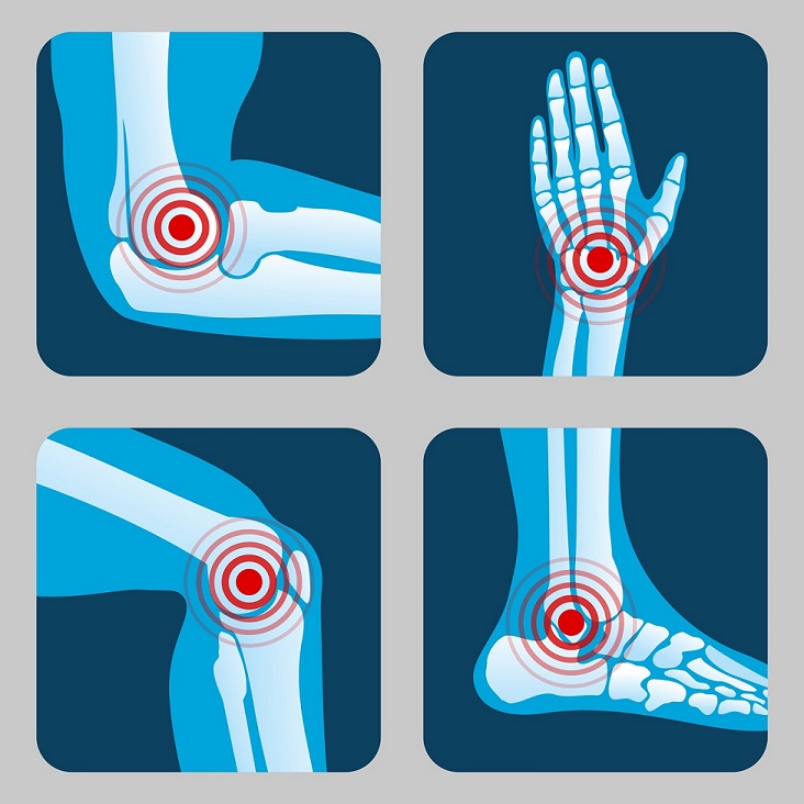 A Perspective on osteoarthritis